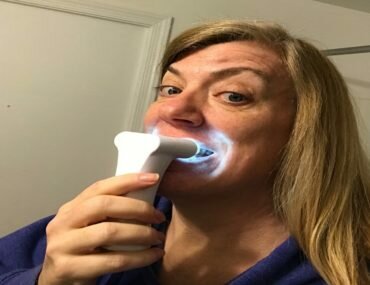 Luster Pro White System Review